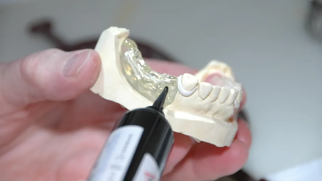 Dentallabor-Zahntechnik